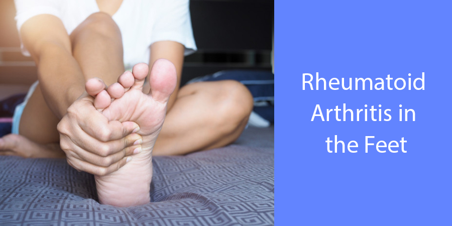 Rheumatologist in Ahmedabad